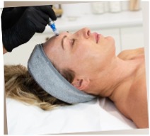 Skin Needling